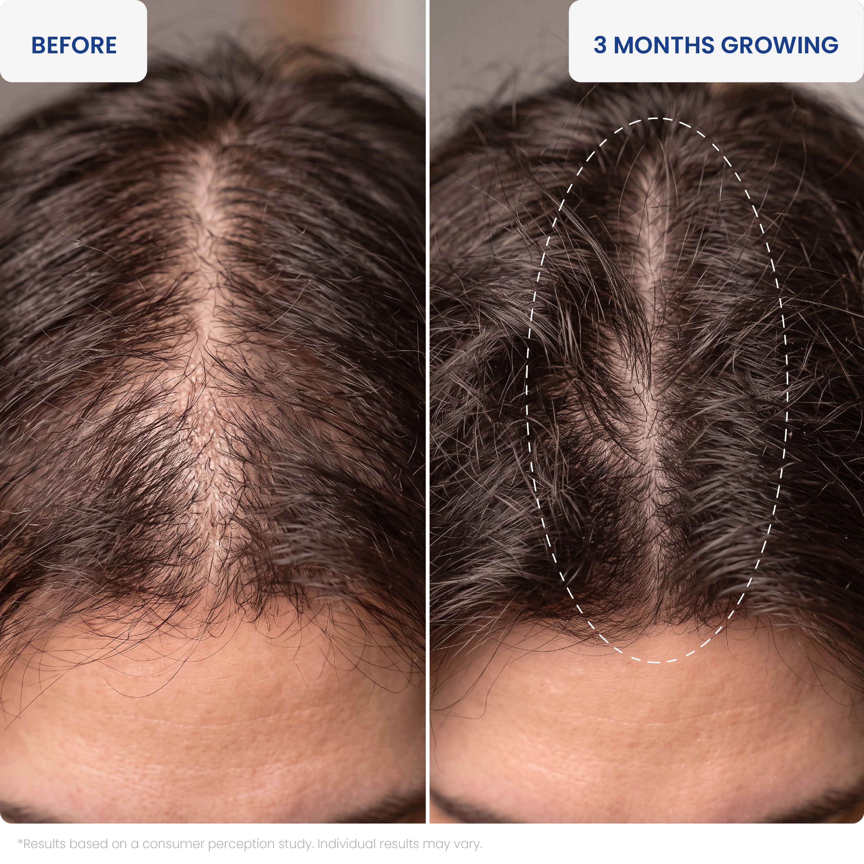 DJM Folicode Advanced Scalp Revitalizing Serum