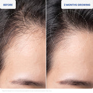 DJM Folicode Scalp Revitalizing Serum