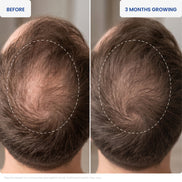 DJM Folicode Scalp Revitalizing Serum