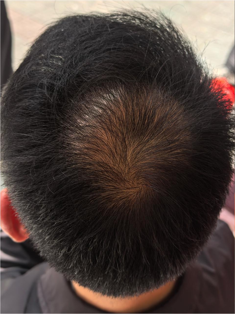 After image