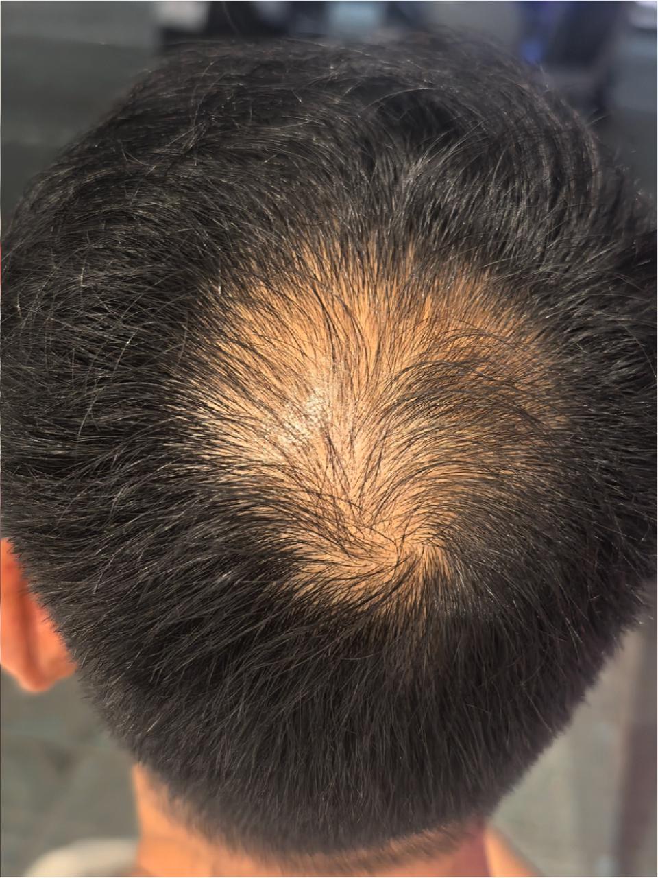 Before image
