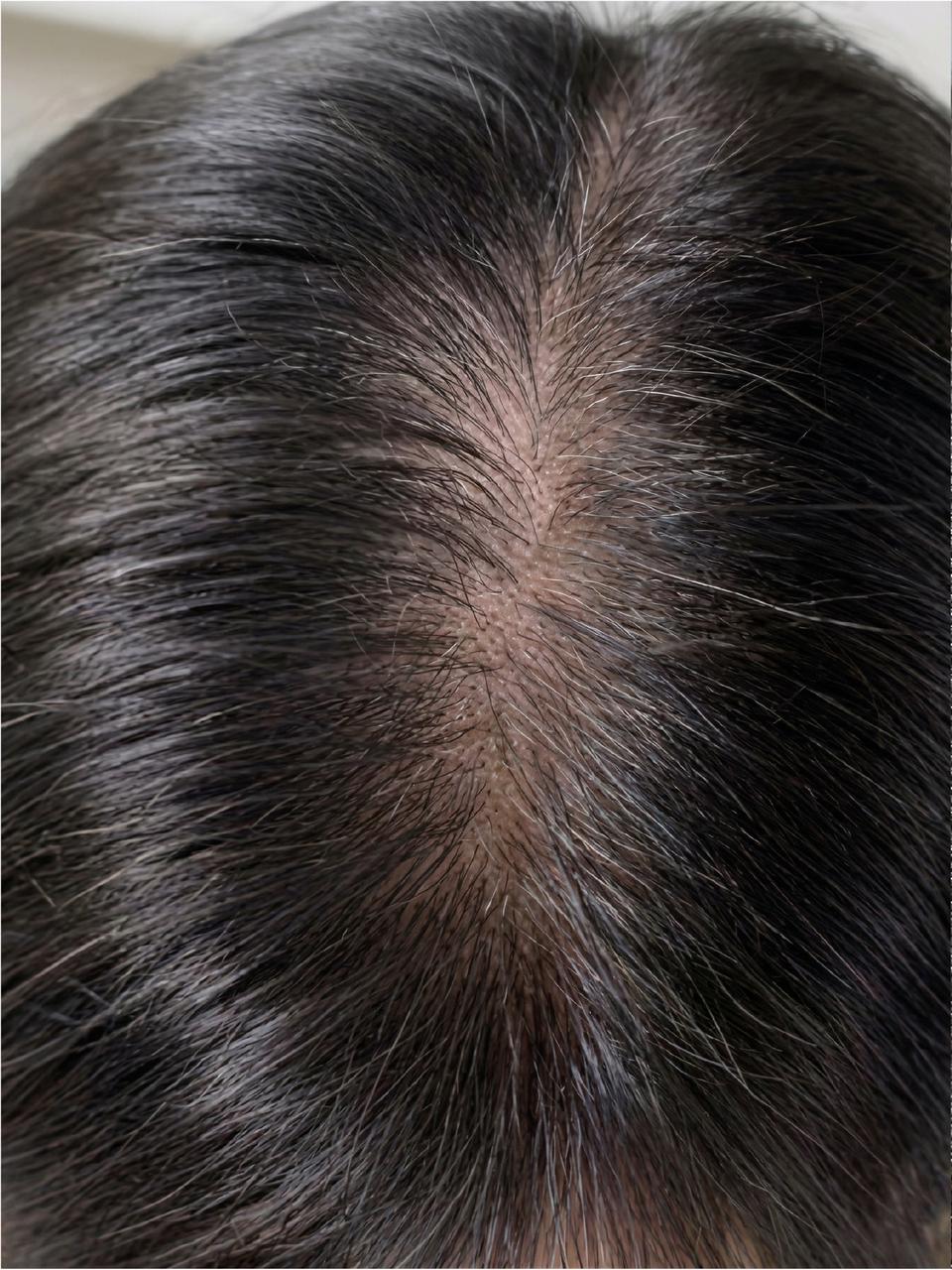 After image